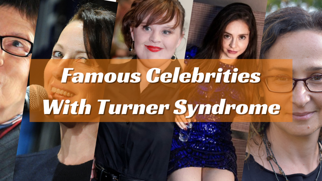 Top 10 Famous Celebrities With Turner Syndrome